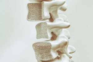 Nedostatok vitamínu K2 sa môže prejaviť vznikom osteoporózy